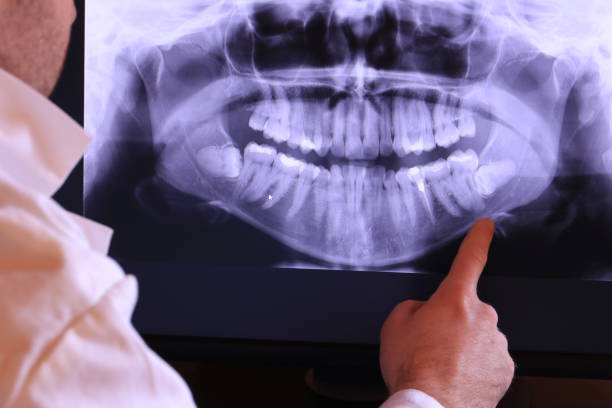 Best Emergency Dental Care for Broken or Chipped Teeth in Lisbon, ME