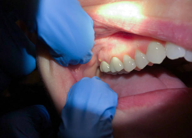 Best After-Hours Dental Trauma Care in Lisbon, ME