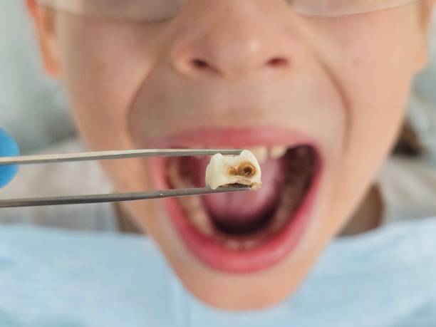 Best Pediatric Emergency Dentist in Lisbon, ME